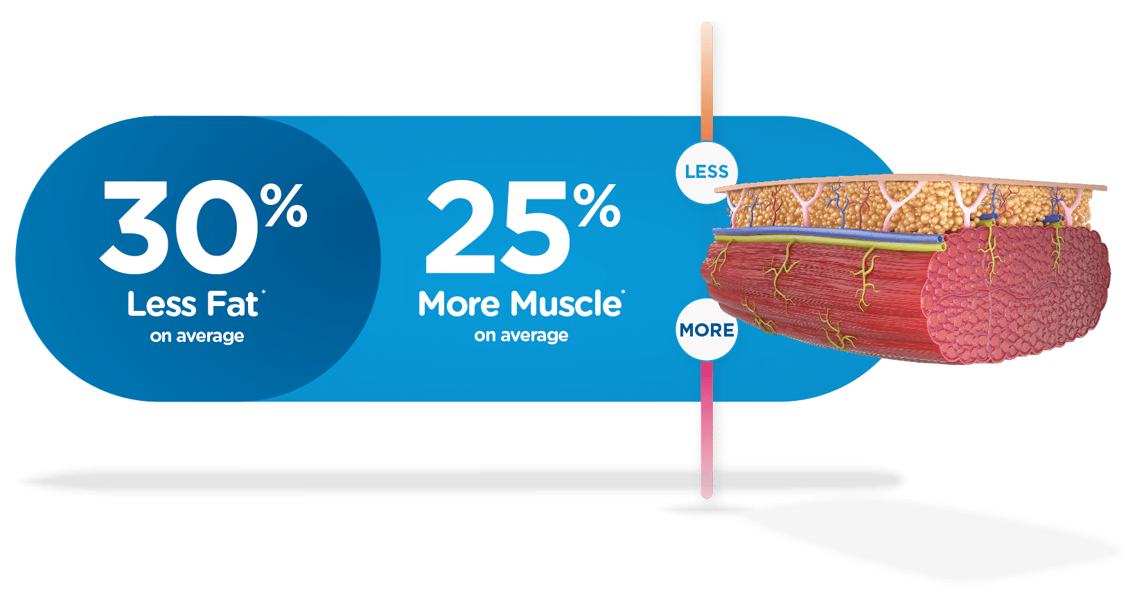 EmSculpt NEO treatment areas