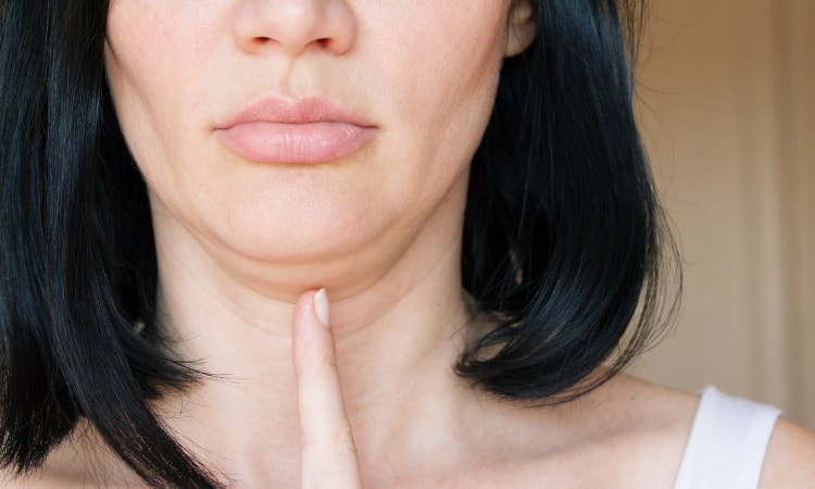 Woman showing double chin by pointing to excess fat under the chin