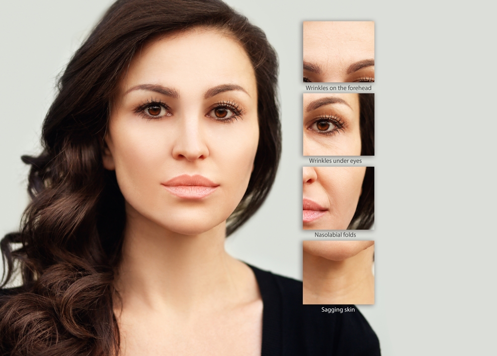 womans face with highlights of wrinkled areas treated by Manhattan Aesthetics