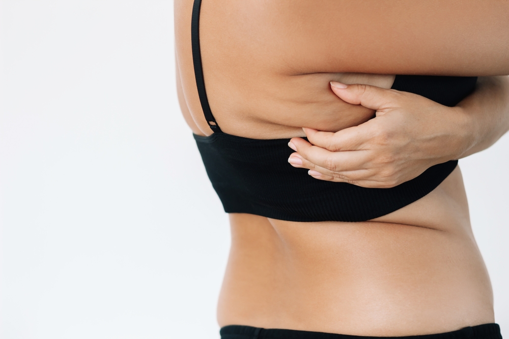 woman squeezing her back roll on top of bra