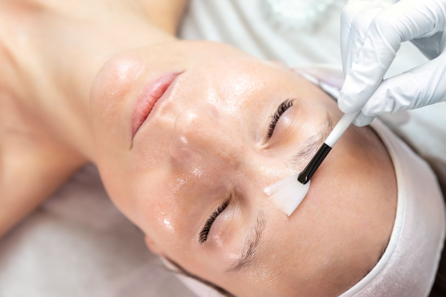 Aesthetician applying chemical peel solution to a woman's forehead with a brush