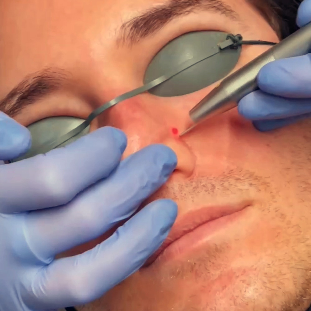 Skin Condition Treatments New York City