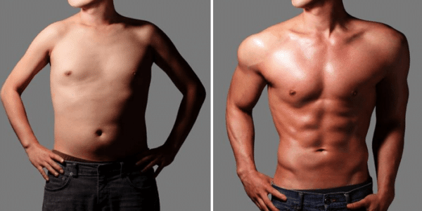 Sculpsure-Treatment-New-York-City