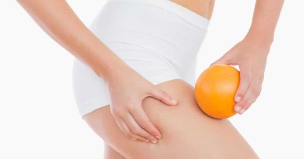 Qwo Cellulite Treatment Manhattan