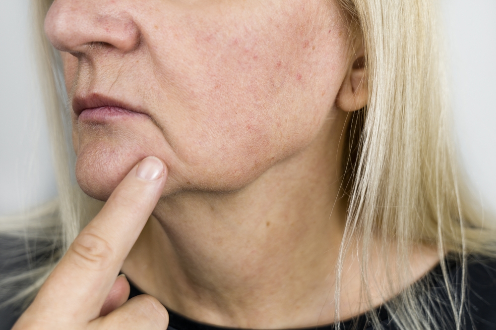 mature woman pointing to sagging jawline following weightless